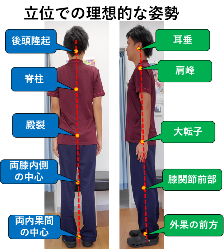 頭部前方位姿勢とはどんな姿勢ですか?, 頭頸部前方位姿勢 – KFSWCU